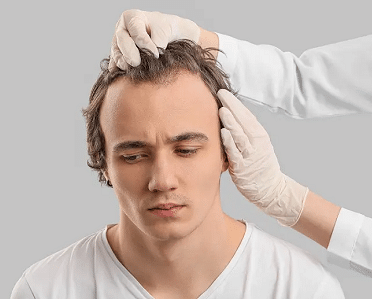 HAIR TRANSPLANTS LIVERPOOL