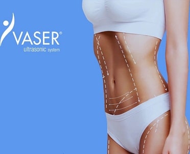 vaser banner