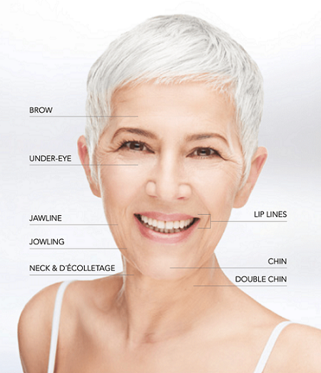 non-surgical lift Liverpool