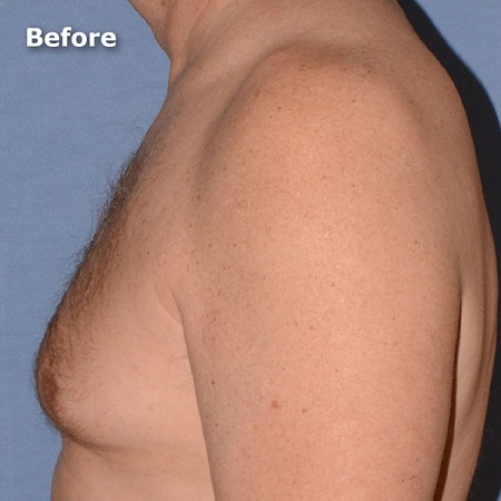 cosmetic surgery Liverpool