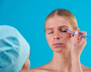 Blepharoplasty Liverpool