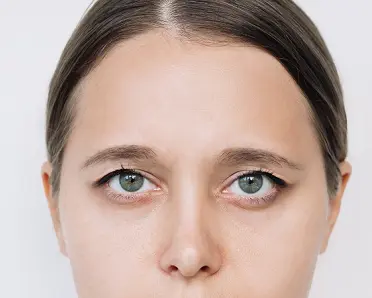 Lower Blepharoplasty in Liverpool