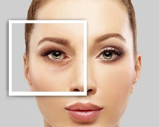 eye bag removal Liverpool