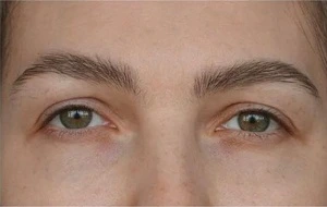 eyebrow restoration liverpool