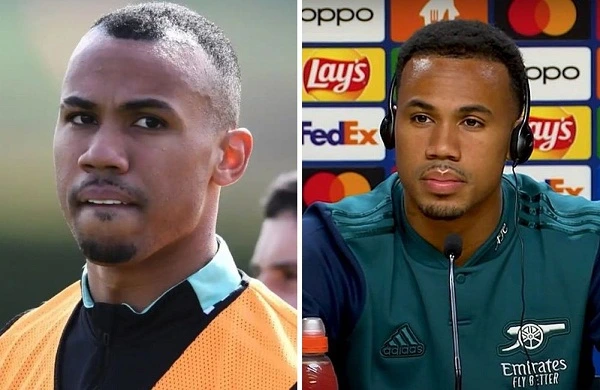 Gabriel Magalhaes before and after hair transplant