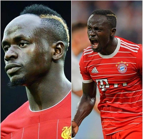 Sadio Mane hair transplant