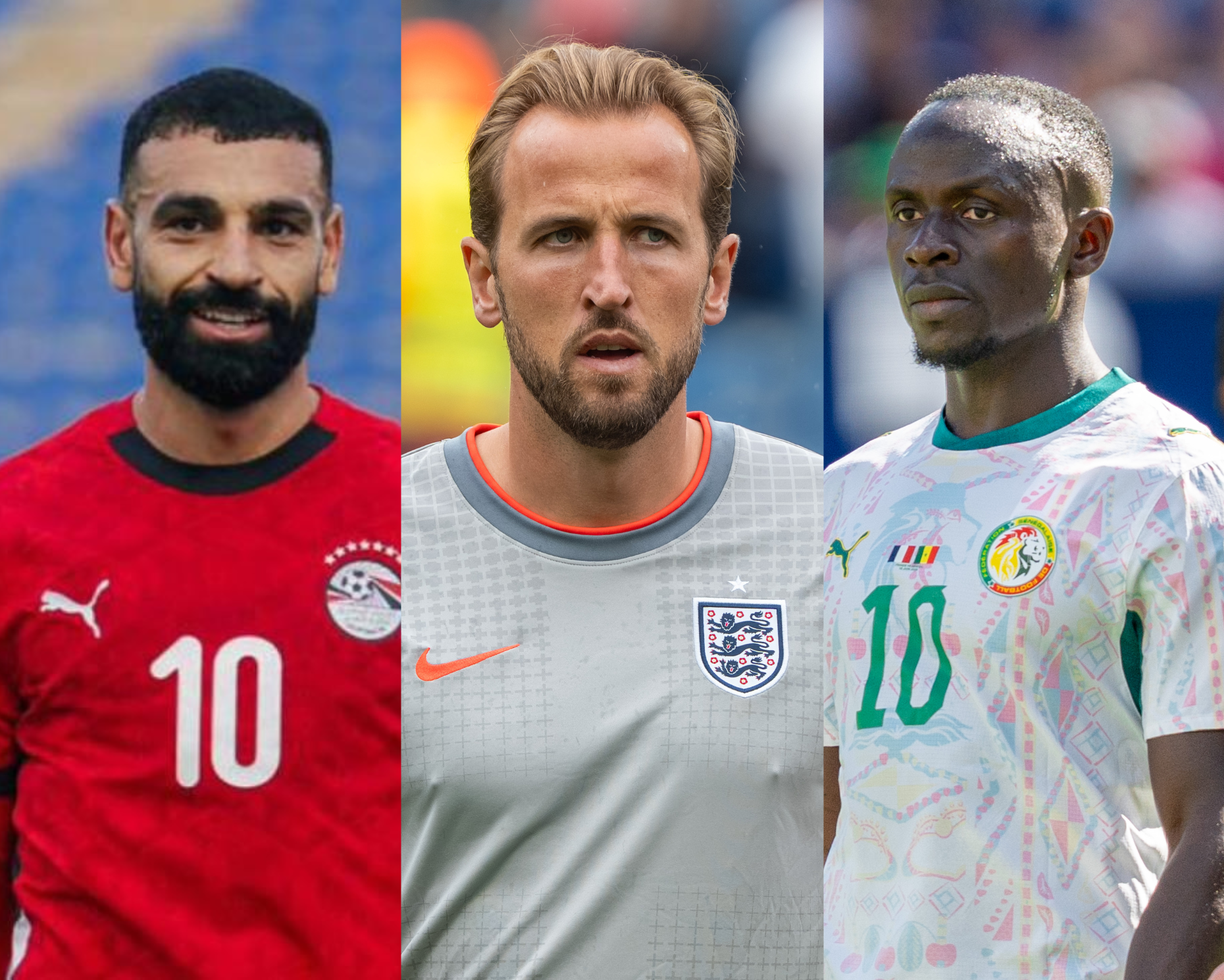 world cup footballers hair transplants