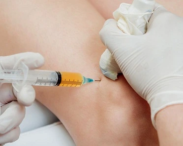 arthrosamid Knee injections for Arthritis