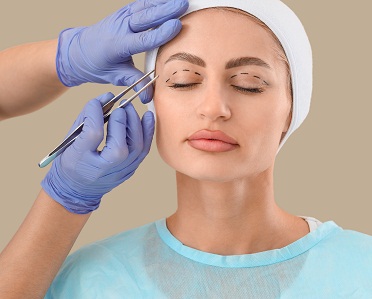 blepharoplasty eyelid surgery